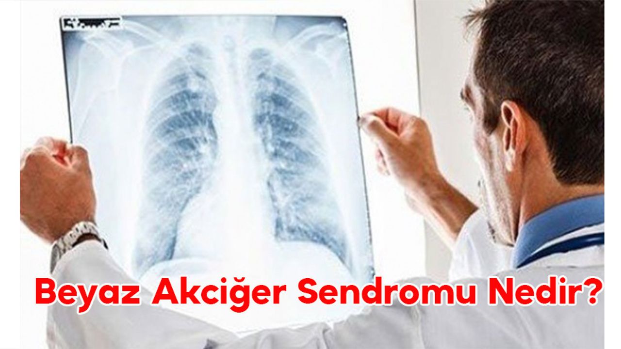 Beyaz Akciğer Sendromu Nedir?