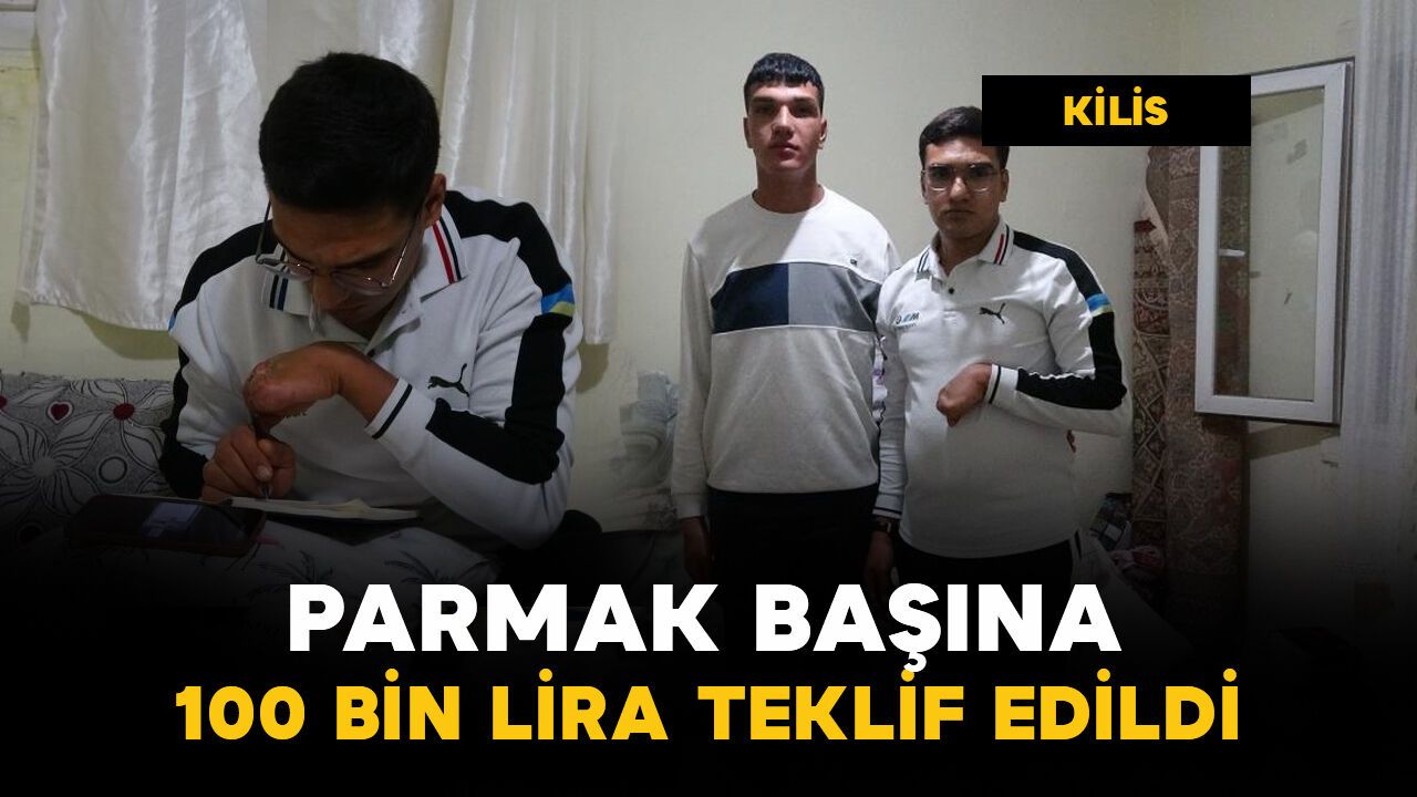Kilis'te 5 parmağını kaybetti, parmak başına 100 bin lira teklif edildi
