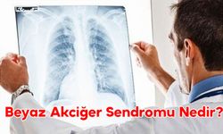 Beyaz Akciğer Sendromu Nedir?