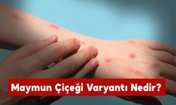 Maymun Çiçeği Varyantı Nedir?