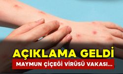 Maymun Çiçeği Virüsü Açıklaması Geldi