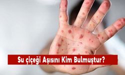 Su Çiçeği Aşısını Kim Bulmuştur?