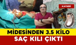 Kızın midesinden çıkanlar hayrete düşürdü