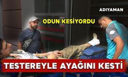 Odun keserken ayağını kesti