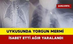 Uykusunda yorgun mermi isabet etti ağır yaralandı