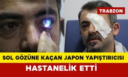 Japon yapıştırıcısı gözüne kaçtı hastanelik oldu