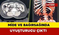 Mide ve bağırsağından çıkan uyuşturucu pes dedirtti