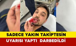 Sadece Yakın Takiptesin Çık Uyarısı Yaptı