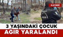 Başıboş köpekler saldırdı: 3 yaşındaki çocuk ağır yaralı