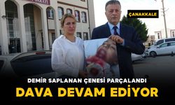 Demir saplanan çenesi parçalandı: dava devam ediyor