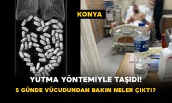 Yutma Yöntemiyle Taşıdı! 5 Günde Vücudundan 62 Paket Uyuşturucu Çıktı