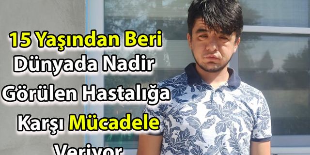 Dünyada Nadir Görülen Hastalığa Karşı Mücadele Veriyor