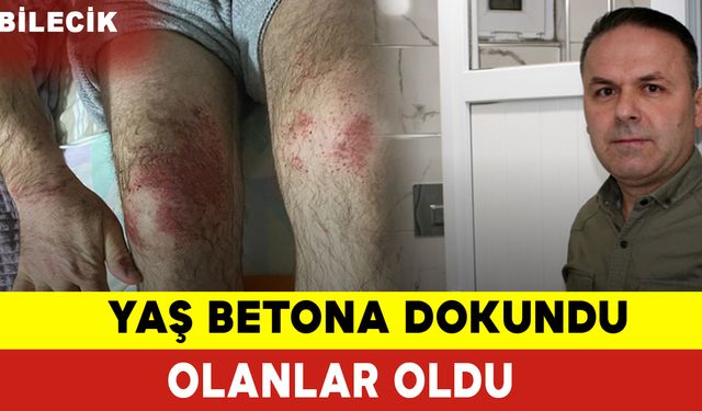 Yaş Betona Dokundu Olanlar Oldu