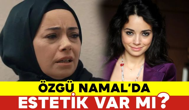 Özgü Namal’da Estetik Var mı?