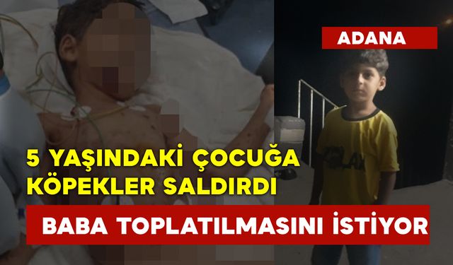 5 Yaşındaki Çocuğa Köpekler Saldırdı