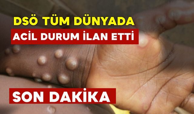 DSÖ Tüm Dünyada Acil Durum İlan Etti