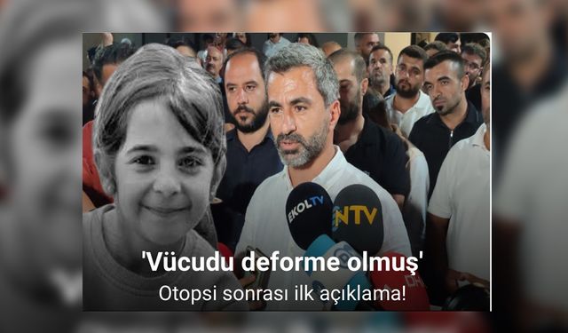 19 Günden Kaynaklı Deformeler Olmuş