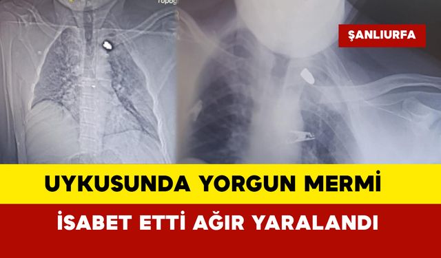 Uykusunda yorgun mermi isabet etti ağır yaralandı