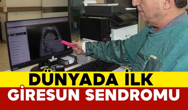 Dünyada İlk: Giresun Sendromu'nun tedavisi var mı?