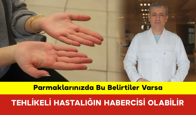 Parmaklarınızda Bu Belirtiler Varsa Tehlikeli Hastalığın Habercisi Olabilir