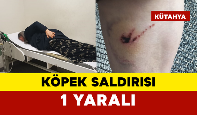 Köpek Saldırısı: Bir Kadın Yaralı