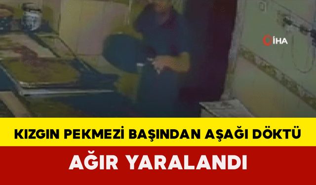 Kızgın pekmezi başından aşağı döktü, ağır yaralı