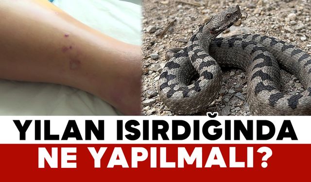 Yılan Isırdığında Ne Yapılmalı?