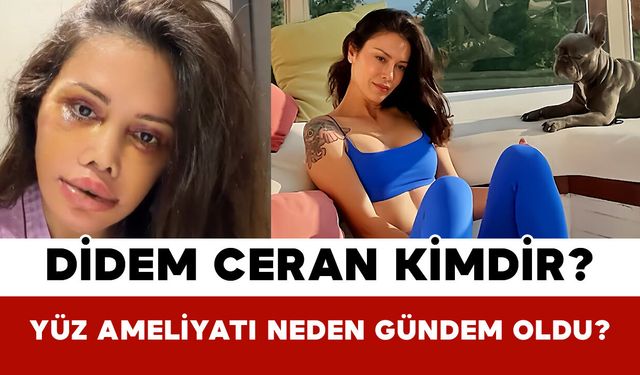 Didem Ceran Kimdir? Yüz Ameliyatı Neden Gündem Oldu?