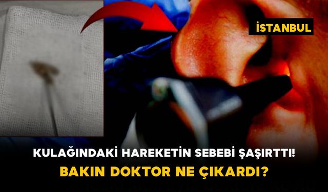 Kulağındaki Hareketin Sebebi Şaşırttı! Bakın Doktor Ne Çıkardı?
