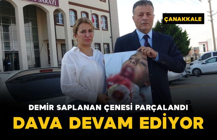Demir saplanan çenesi parçalandı: dava devam ediyor