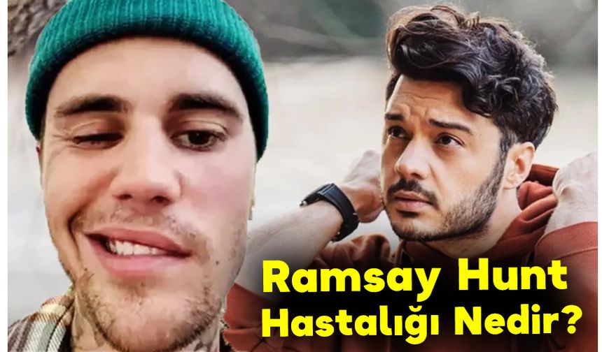 Ramsay Hunt Hastalığı Nedir?