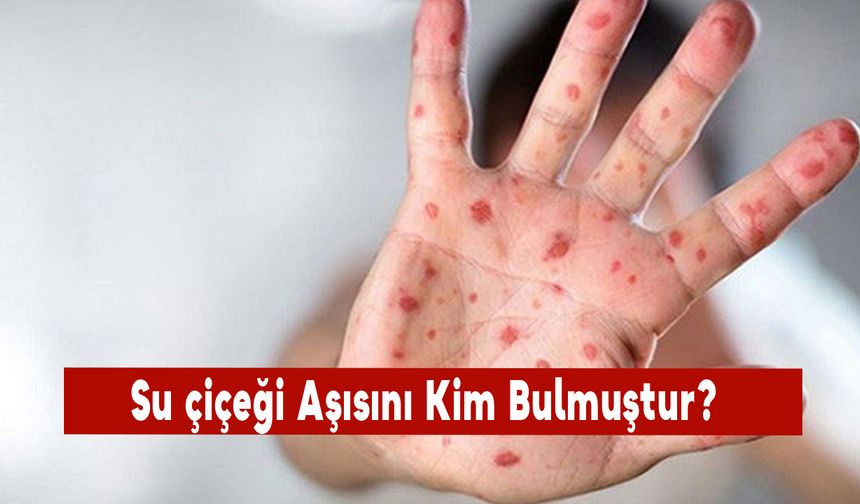 Su Çiçeği Aşısını Kim Bulmuştur?