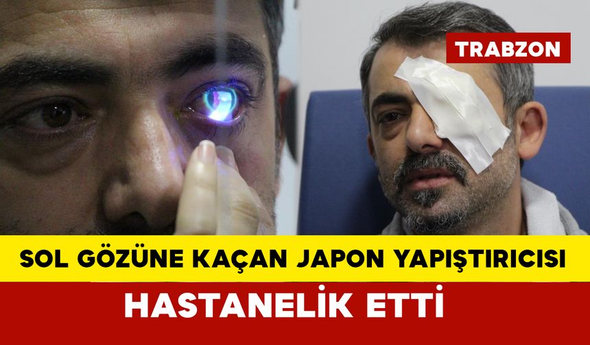 Japon yapıştırıcısı gözüne kaçtı hastanelik oldu