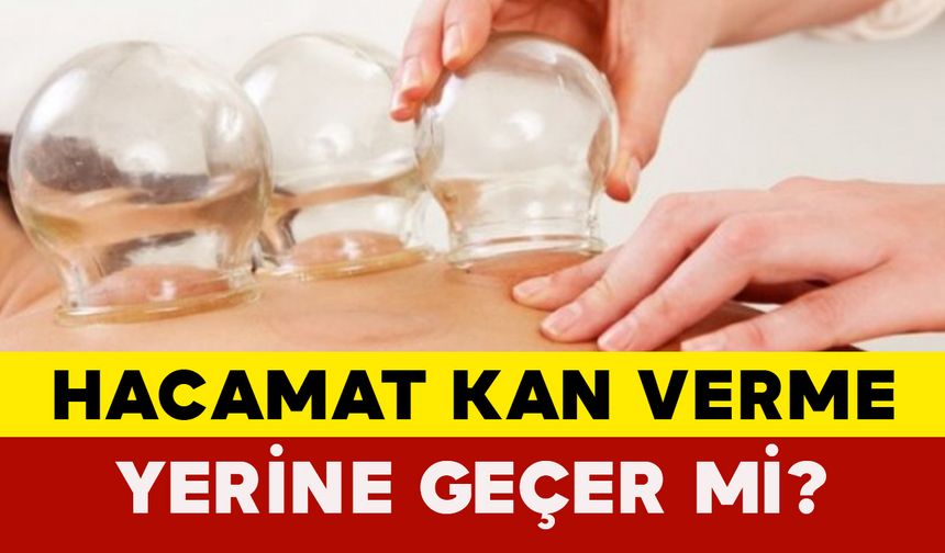 Hacamat Kan Verme Yerine Geçer Mi?