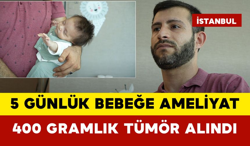 5 Günlük Bebeğe Ameliyat: 400 Gramlık Tümör Alındı