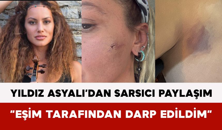 Yıldız Asyalı’dan Sarsıcı Paylaşım: “Eşim Tarafından Darp Edildim”