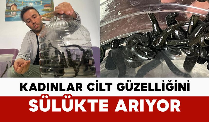 Mezbaha kanıyla besleniyor, kadınlar cilt güzelliğini sülükte arıyor