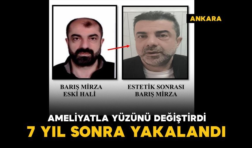 Ameliyat ile yüzünü değiştirdi: firari cinayet zanlısı, 7 yıl sonra yakalandı