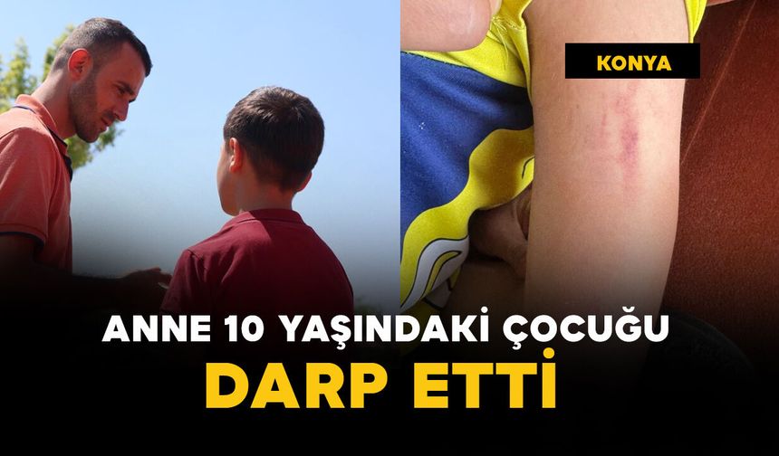 Öğrenci kavgasında anne 10 yaşındaki çocuğu darp etti