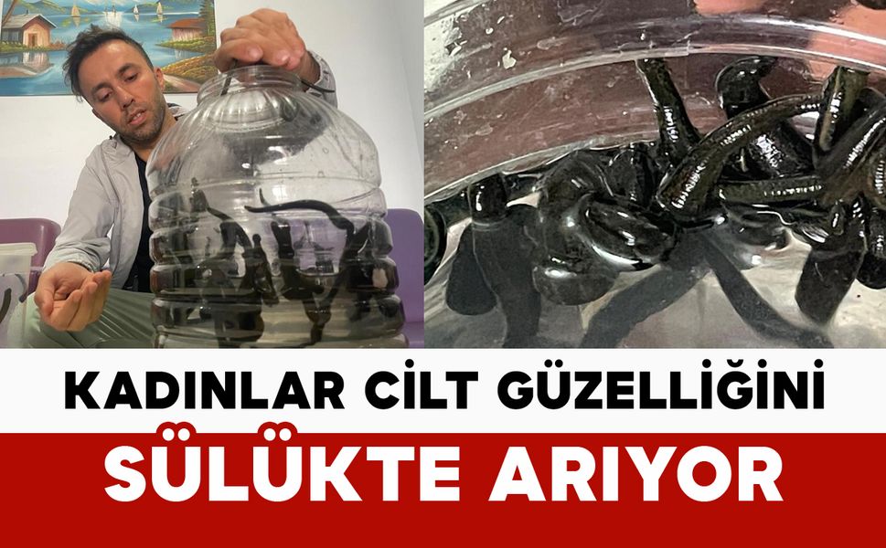 Mezbaha kanıyla besleniyor, kadınlar cilt güzelliğini sülükte arıyor