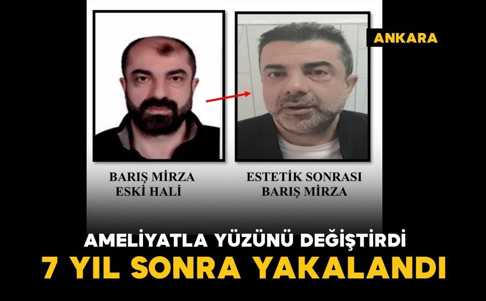 Ameliyat ile yüzünü değiştirdi: firari cinayet zanlısı, 7 yıl sonra yakalandı