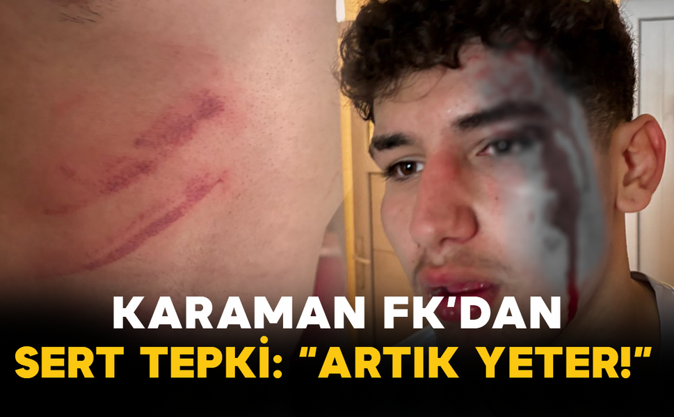 Karaman FK’dan Sert Tepki: “Artık Yeter!”