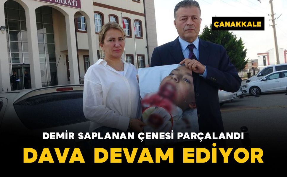 Demir saplanan çenesi parçalandı: dava devam ediyor