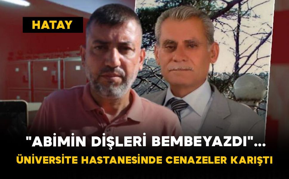 "Abimin Dişleri Bembeyazdı"... Üniversite Hastanesinde Cenazeler Karıştı