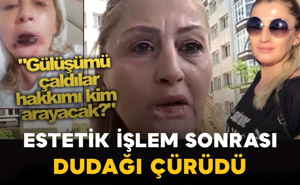 Estetik işlem sonrası dudağı çürüdü