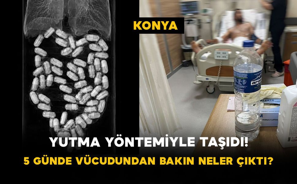 Yutma Yöntemiyle Taşıdı! 5 Günde Vücudundan 62 Paket Uyuşturucu Çıktı