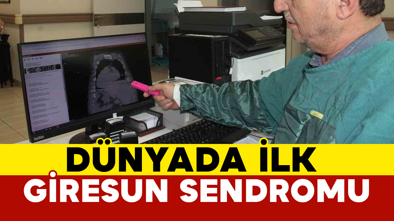 Dünyada İlk Giresun Sendromu