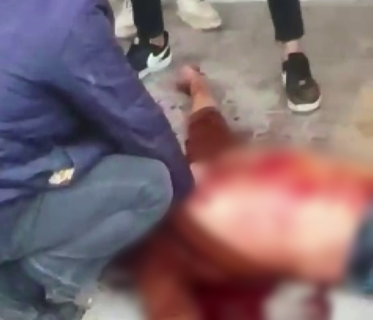 Cocuk Kavgasi Kanli Bitti 1 Olu 2 Yarali (2)