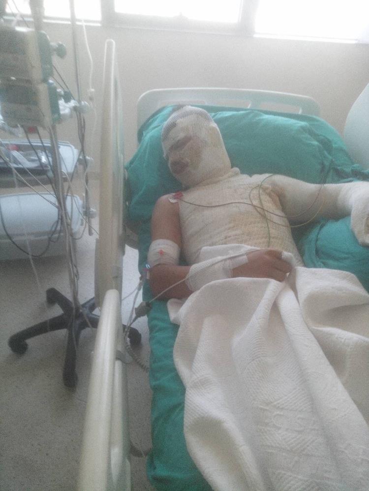 Yegenini Yakan Amca Sucu Abisine Atti Ama Bir Seyi Hesap Edemedi3