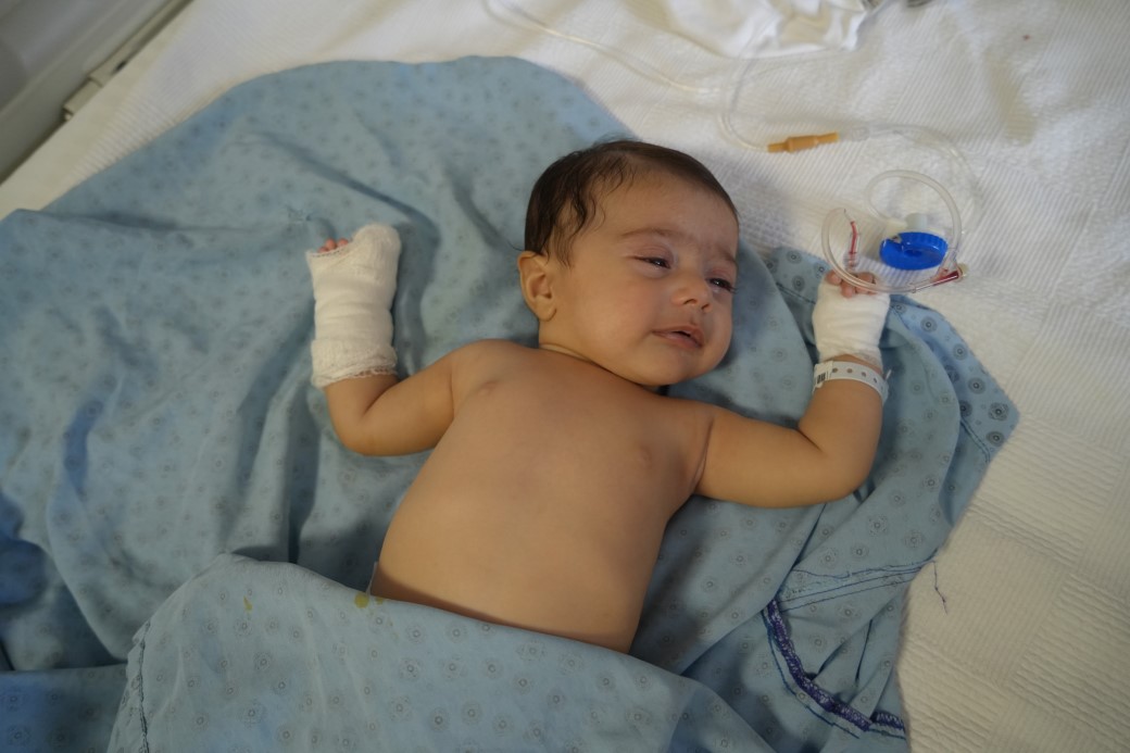 Hastanede Skandal Bebegin Parmagi Kesildi (2)